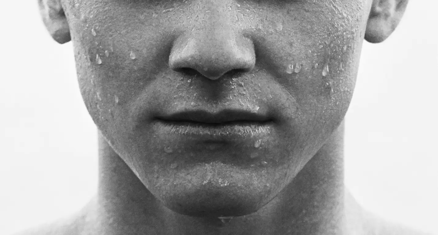 FÜR MÄNNER, DIE FRISCHER AUSSEHEN WOLLEN – BOTULINUMTOXIN